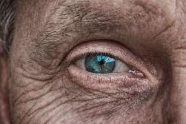 THEY ARE NOT JUST SIGN OF AGING: Wrinkles reveal your personality and health problem you've got